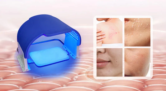 Blue Light Therapy: How It Heals Your Skin