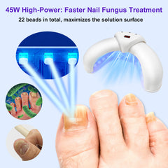 New Nail Fungus Laser Treatment for Toenails and Fingernails Home Use Reliable