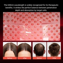 Laser Red Light Therapy for Hair Growth - FDA Cleared Hair Loss, Hair Thinning & Alopecia Treatment for Men & Women - Stimulate Denser Fuller Hair